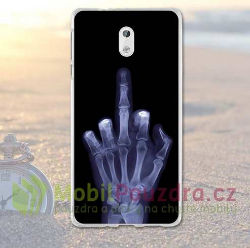 Gelové pouzdro s obrázkem na NOKIA 3 (2017) - vzor RENTGEN