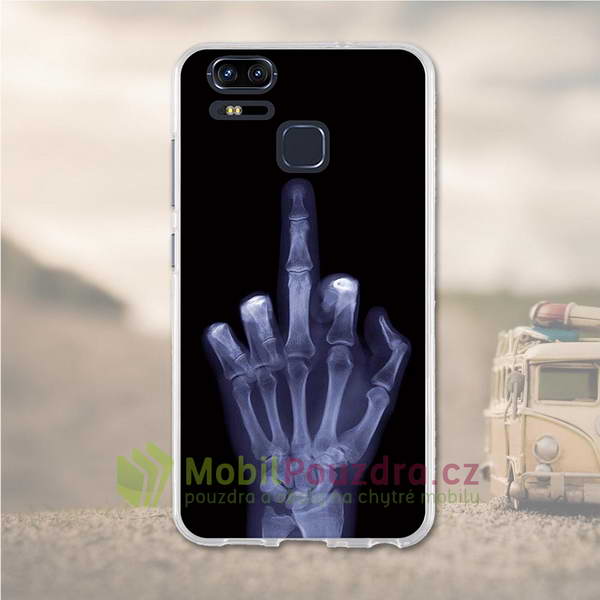 Gelové pouzdro s obrázkem na ASUS ZenFone 3 Zoom S ZE553KL - vzor RENTGEN