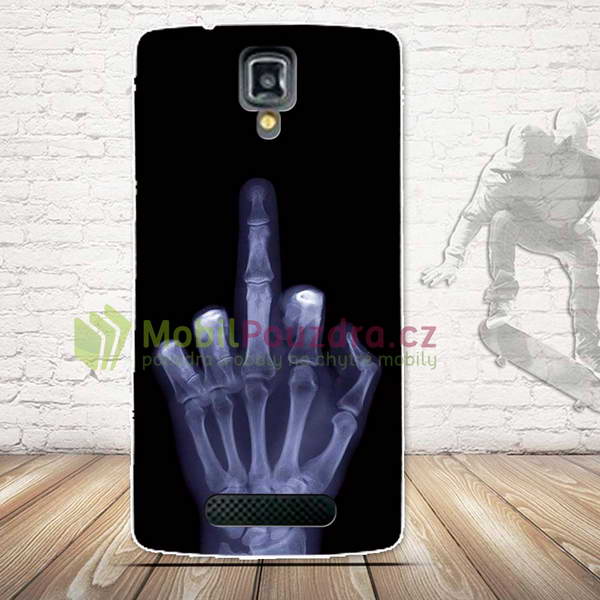 Gelové pouzdro s obrázkem na LENOVO A1000 - vzor RENTGEN