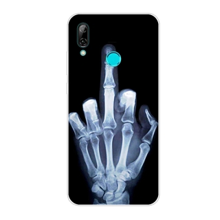Gelové pouzdro s obrázkem na SAMSUNG A505 Galaxy A50 / A307 Galaxy A30s - vzor RENTGEN